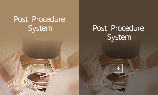 사후 추적관찰 프로그램 추적 관찰 및 성공적 결과