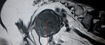 히스토리 썸네일