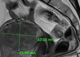 고해상도 MRI 영상