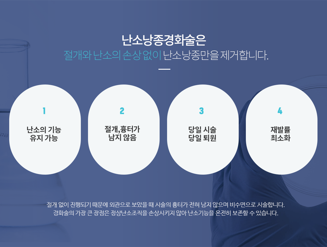 난소낭종경화술 특징