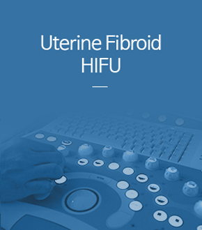 자궁근종 하이푸 치료
