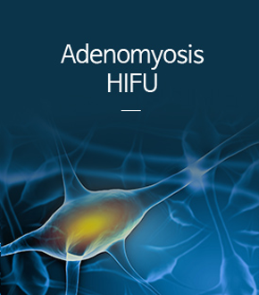 자궁선근증 하이푸 치료